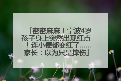 密密麻麻！宁波4岁孩子身上突然出现红点！连小便都变红了……家长：以为只是摔伤